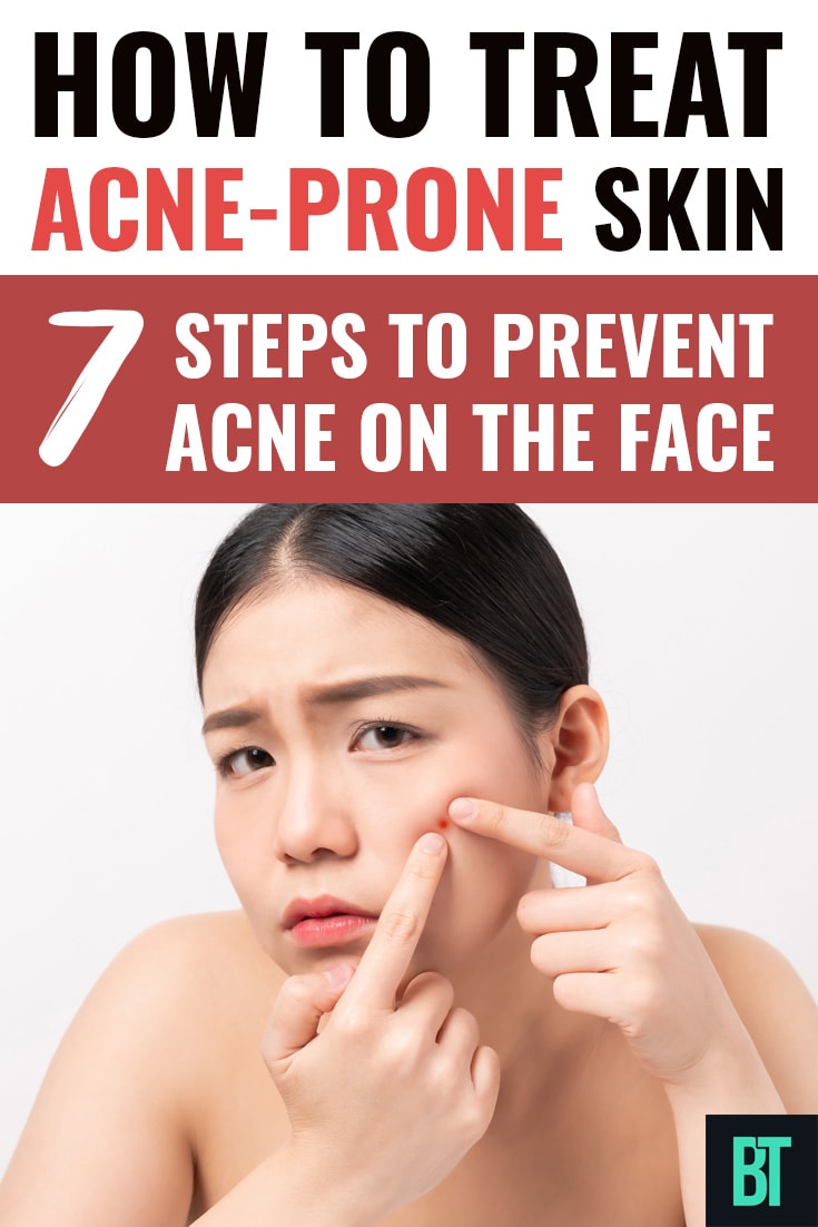 How to Treat Acne-Prone Skin: 7 Ways to Prevent Acne at-Home!