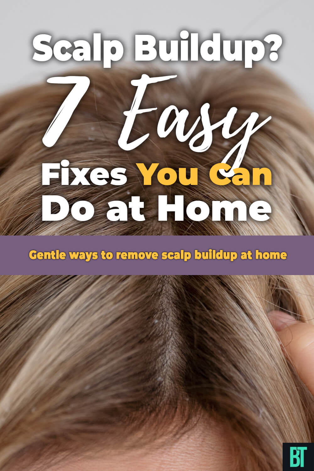 How to Remove Scalp Buildup at Home: 7 Gentle Methods That Actually Work